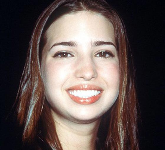 لن تصدقوا كيف كان شكل ايفانكا ترامب! صور قبل وبعد عمليات التجميل! صورة رقم 4