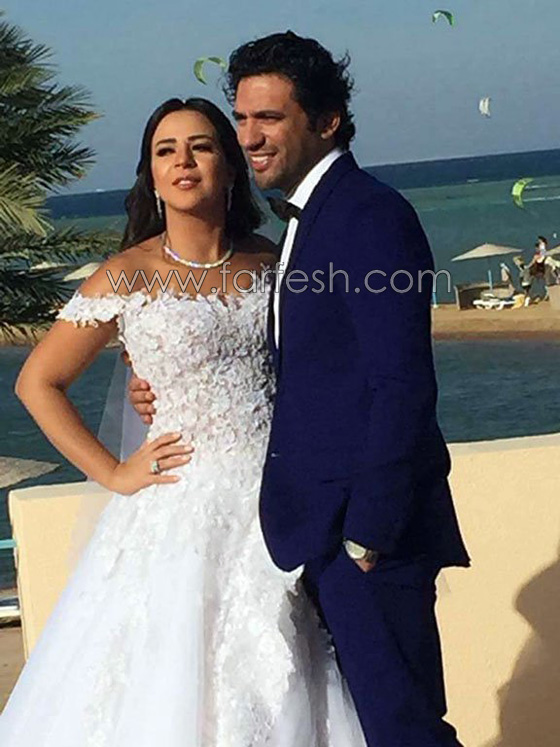  فيديو ايمي سمير غانم توضح حقيقة مرضها بانفعال وغضب شديدين! صورة رقم 7