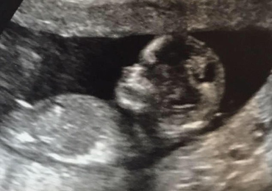  أكبر اسرة بريطانية تنتظر مولودها الـ20 وتؤكد: سيكون الأخير.. صورة رقم 1