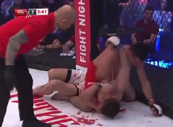 شاهدوا  ماذا فعلت أم بأبنها لأنه خسر بالملاكمة.. فيديو صورة رقم 2