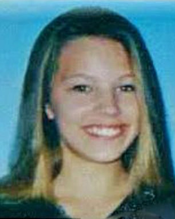  عارضة أزياء ترفض الخروج من بيتها طيلة 6 سنوات بعد أن تشوه وجهها! صورة رقم 10