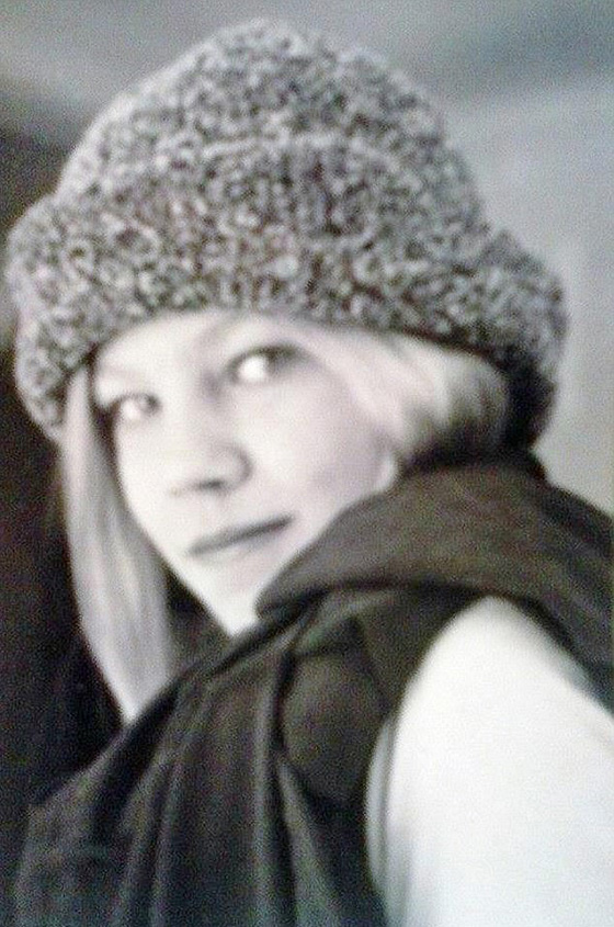  عارضة أزياء ترفض الخروج من بيتها طيلة 6 سنوات بعد أن تشوه وجهها! صورة رقم 9