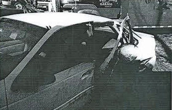  عارضة أزياء ترفض الخروج من بيتها طيلة 6 سنوات بعد أن تشوه وجهها! صورة رقم 5