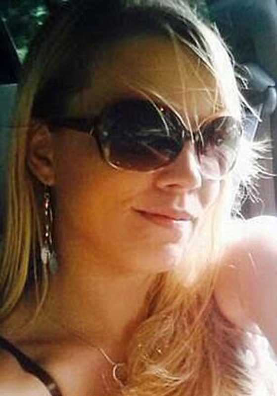  عارضة أزياء ترفض الخروج من بيتها طيلة 6 سنوات بعد أن تشوه وجهها! صورة رقم 3