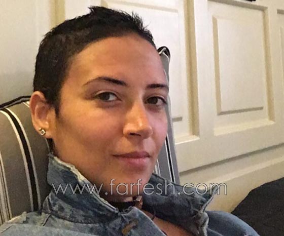مريضة سرطان حقيقية بطلة جريئة تبهر مشاهدي مسلسل حلاوة الدنيا صورة رقم 2