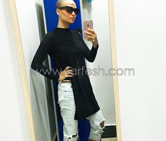 مريضة سرطان حقيقية بطلة جريئة تبهر مشاهدي مسلسل حلاوة الدنيا صورة رقم 4