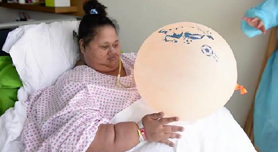 واخيرا: تحسن حالة المصرية ايمان احمد صاحبة النصف طن .. بالفيديو صورة رقم 2