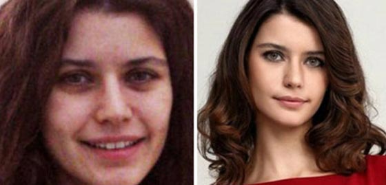 هل تحتمل الصدمة؟! النجمات التركيات مع وبدون مكياج.. صور صورة رقم 10