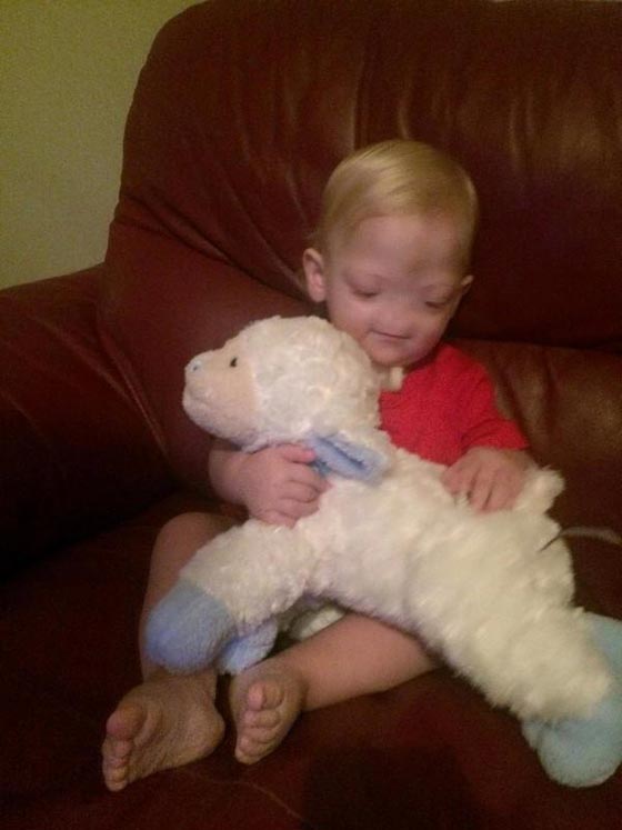 عائلة الطفل المعجزة المولود بدون انف تعلن وفاته عن عمر سنتين! صورة رقم 4