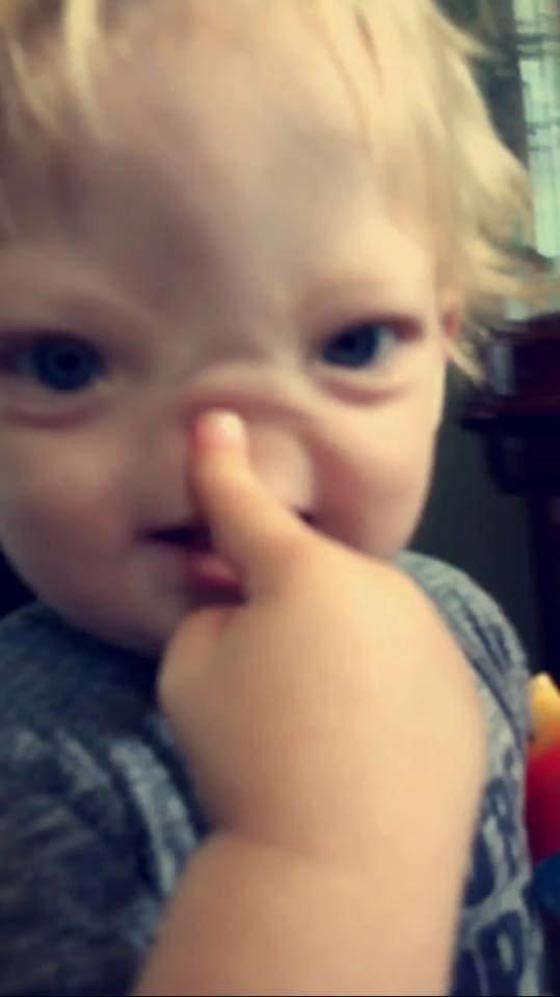 عائلة الطفل المعجزة المولود بدون انف تعلن وفاته عن عمر سنتين! صورة رقم 5