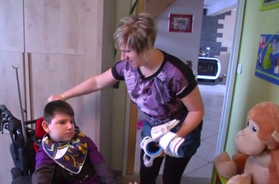 قضية مروعة.. تناول الطفل شريحة لحم مفروم فاصيب بشلل واعاقة دائمة صورة رقم 2