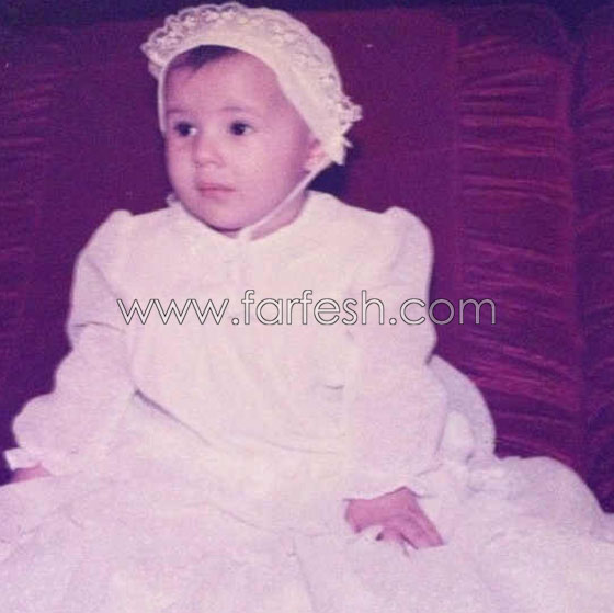 صور وفيديو دنيا سمير غانم أيام الطفولة والمراهقة تكشف اسرار عمليات التجميل صورة رقم 6