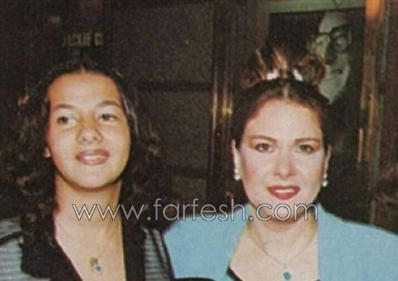 صور وفيديو دنيا سمير غانم أيام الطفولة والمراهقة تكشف اسرار عمليات التجميل صورة رقم 2