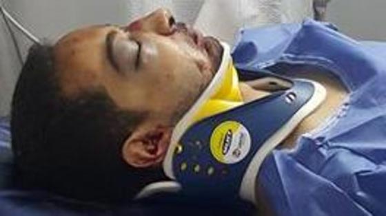 فيديو مروّع.. شاب مصري يسقط من لعبة ملاهي ويصاب بكسور خطيرة صورة رقم 2