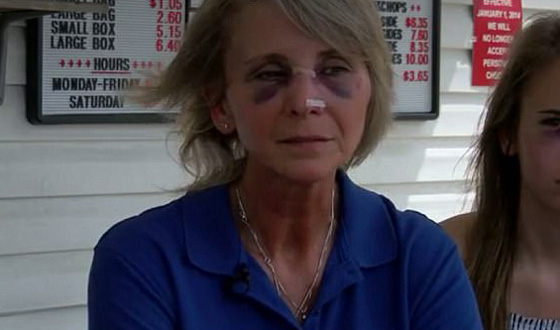 بالفيديو.. زوجان يعتديان بالضرب على سيدة وابنتها بسبب وجبة صورة رقم 11