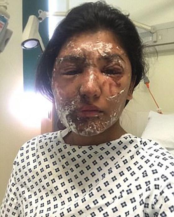 مهاجم الحسناء المسلمة وقريبها بالاسيد الحارق يسلم نفسه لشرطة لندن صورة رقم 5