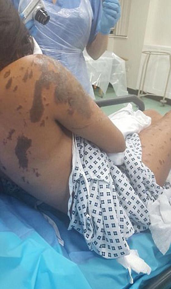 مهاجم الحسناء المسلمة وقريبها بالاسيد الحارق يسلم نفسه لشرطة لندن صورة رقم 7