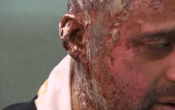 مهاجم الحسناء المسلمة وقريبها بالاسيد الحارق يسلم نفسه لشرطة لندن صورة رقم 10