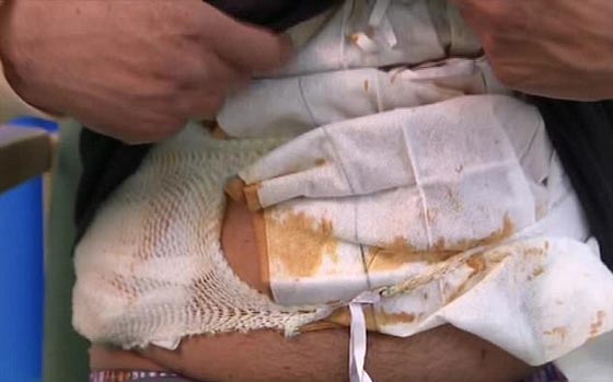 مهاجم الحسناء المسلمة وقريبها بالاسيد الحارق يسلم نفسه لشرطة لندن صورة رقم 11