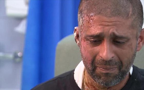 مهاجم الحسناء المسلمة وقريبها بالاسيد الحارق يسلم نفسه لشرطة لندن صورة رقم 12