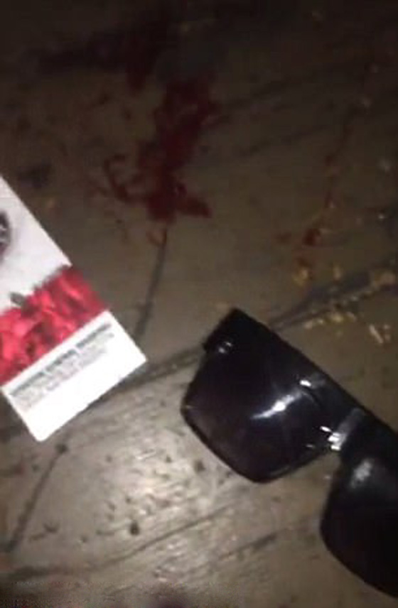 معركة بالاسلحة النارية داخل ملهى مكتظ بالرواد في اركنساس الامريكية صورة رقم 6