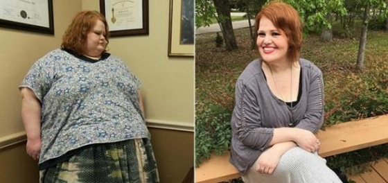 صور قبل وبعد: امرأة خسرت 210 كغم من وزنها! لن تصدق التغيير! صورة رقم 1