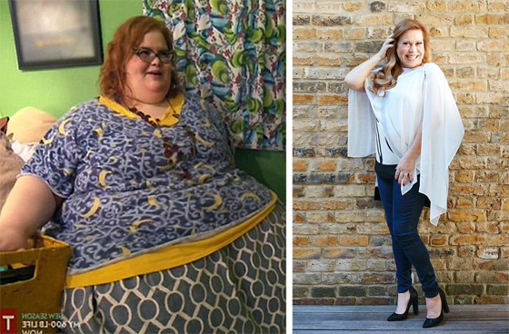 صور قبل وبعد: امرأة خسرت 210 كغم من وزنها! لن تصدق التغيير! صورة رقم 2