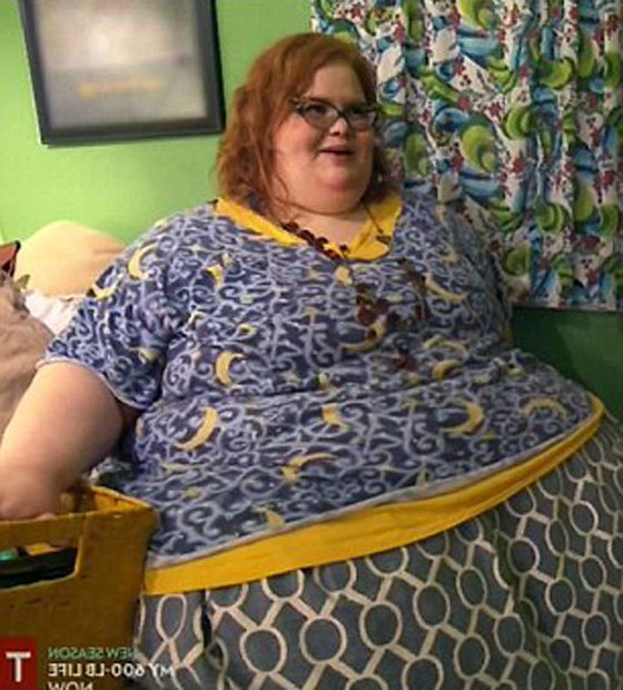 صور قبل وبعد: امرأة خسرت 210 كغم من وزنها! لن تصدق التغيير! صورة رقم 9