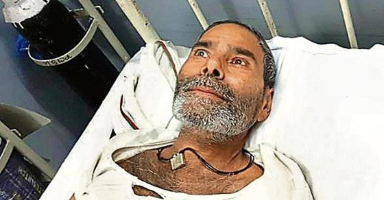 رجل هندي حير الاطباء بعد ان عثروا على 150 دبوسا غرست في جسده صورة رقم 8