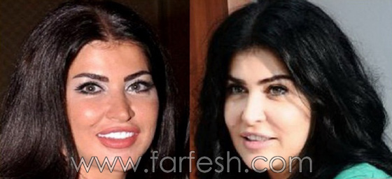  صور جومانا مراد بعد تغير وجهها بسبب عمليات تجميل فاشلة. وما علاقتها بمراد يلدريم؟ صورة رقم 1