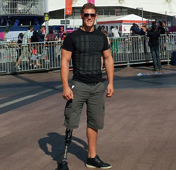 مبتور الساق وعارض ازياء ناجح يتوّج بلقب ملك جمال بريطانيا  صورة رقم 3