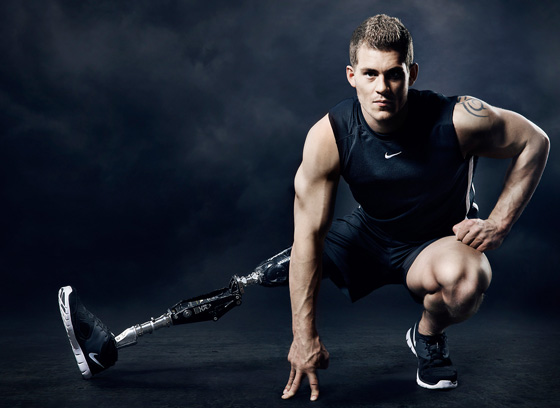 مبتور الساق وعارض ازياء ناجح يتوّج بلقب ملك جمال بريطانيا  صورة رقم 1