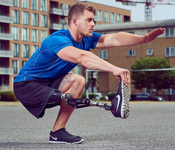 مبتور الساق وعارض ازياء ناجح يتوّج بلقب ملك جمال بريطانيا  صورة رقم 4