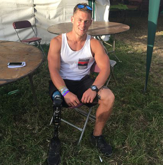 مبتور الساق وعارض ازياء ناجح يتوّج بلقب ملك جمال بريطانيا  صورة رقم 5