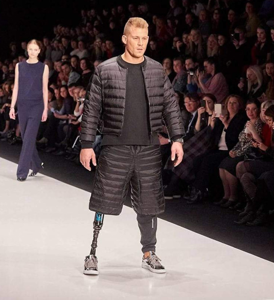 مبتور الساق وعارض ازياء ناجح يتوّج بلقب ملك جمال بريطانيا  صورة رقم 7