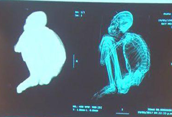 أدلة لمخلوقات فضائية تعيش مع البشر على الكرة الأرضية صورة رقم 3
