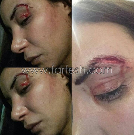 صور: فنانة عربية تودع جمهورها وتكشف اصابتها بالسرطان..  صورة رقم 2