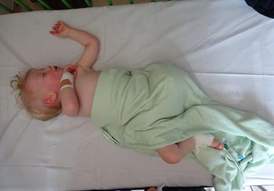 فيديو مؤثر.. طفل يمشي أولى خطواته قبل خضوعه لجراحة بترت فيها ساقه! صورة رقم 5