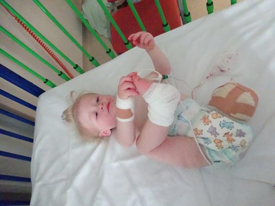 فيديو مؤثر.. طفل يمشي أولى خطواته قبل خضوعه لجراحة بترت فيها ساقه! صورة رقم 4