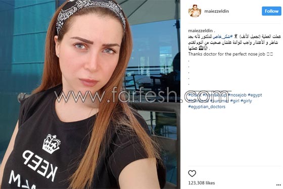 صور مي عز الدين تكشف: أجريت عملية تجميل في أنفي بسبب السيلفي! صورة رقم 1