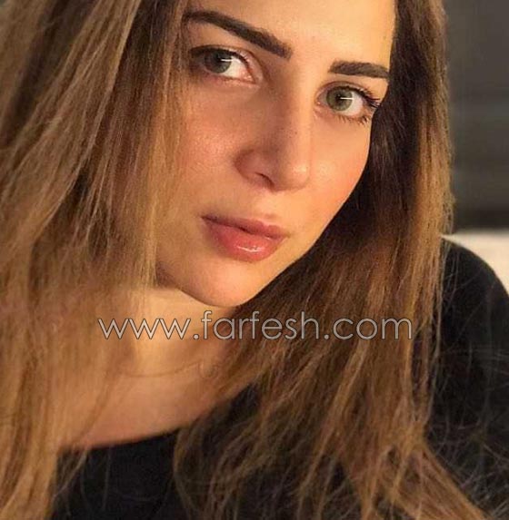 صور مي عز الدين تكشف: أجريت عملية تجميل في أنفي بسبب السيلفي! صورة رقم 3