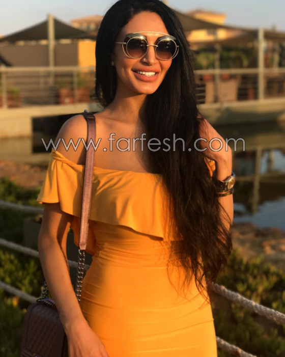 بسبب الحسد والحاسدين: مذيعة مصرية يتساقط شعرها بشكل غريب  صورة رقم 7