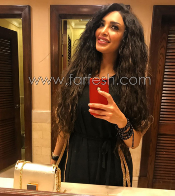بسبب الحسد والحاسدين: مذيعة مصرية يتساقط شعرها بشكل غريب  صورة رقم 16
