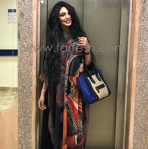 بسبب الحسد والحاسدين: مذيعة مصرية يتساقط شعرها بشكل غريب  صورة رقم 18