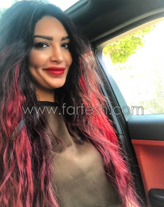 بسبب الحسد والحاسدين: مذيعة مصرية يتساقط شعرها بشكل غريب  صورة رقم 19