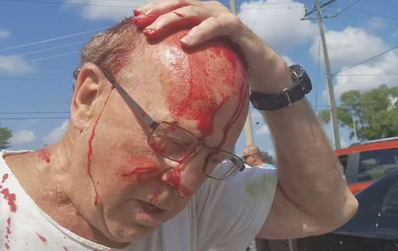 فيديو صادم.. شاهد كيف أدمى سائق شاحنة درّاجاً مسنا ضربا بالهراوة صورة رقم 3