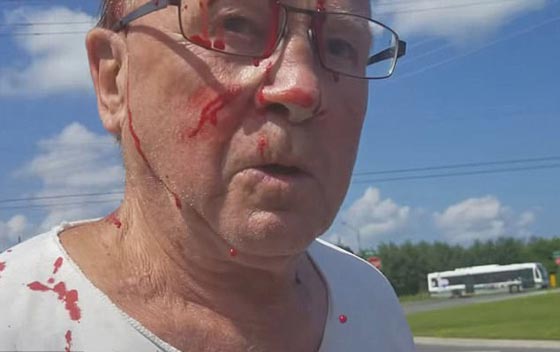 فيديو صادم.. شاهد كيف أدمى سائق شاحنة درّاجاً مسنا ضربا بالهراوة صورة رقم 2