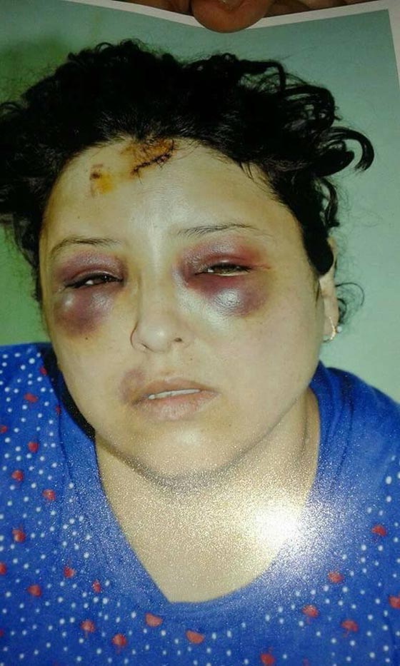 صور مؤلمة.. هذا ما فعلوه بسيدة مصرية بسبب علبة سجائر صورة رقم 4