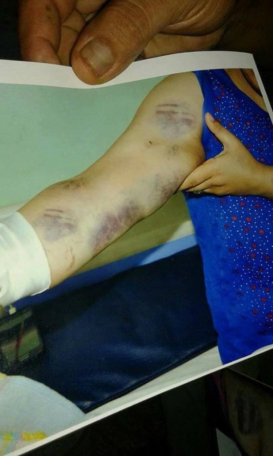 صور مؤلمة.. هذا ما فعلوه بسيدة مصرية بسبب علبة سجائر صورة رقم 2