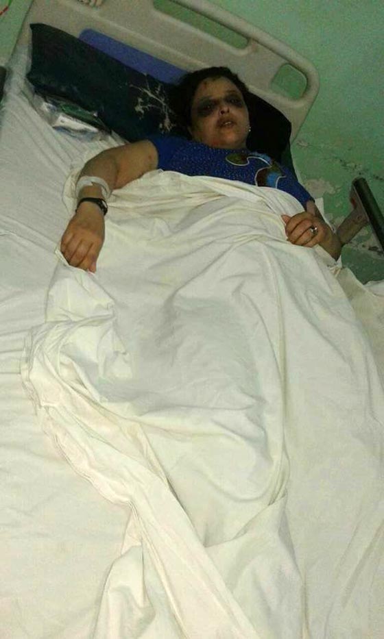 صور مؤلمة.. هذا ما فعلوه بسيدة مصرية بسبب علبة سجائر صورة رقم 3